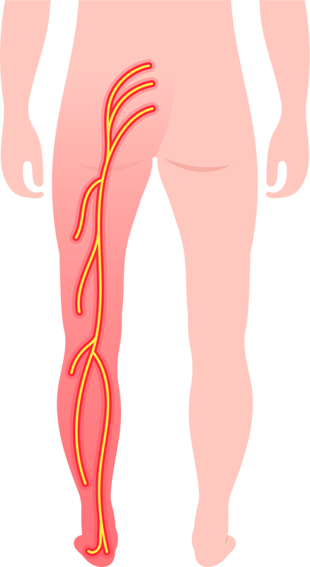 spinal bone disk nerve broken curves poor hunched over back dowager’s pain injury spine density test lumbar disc Piriformis syndrome pinched radiculopathy sacroiliac joint sacroiliitis